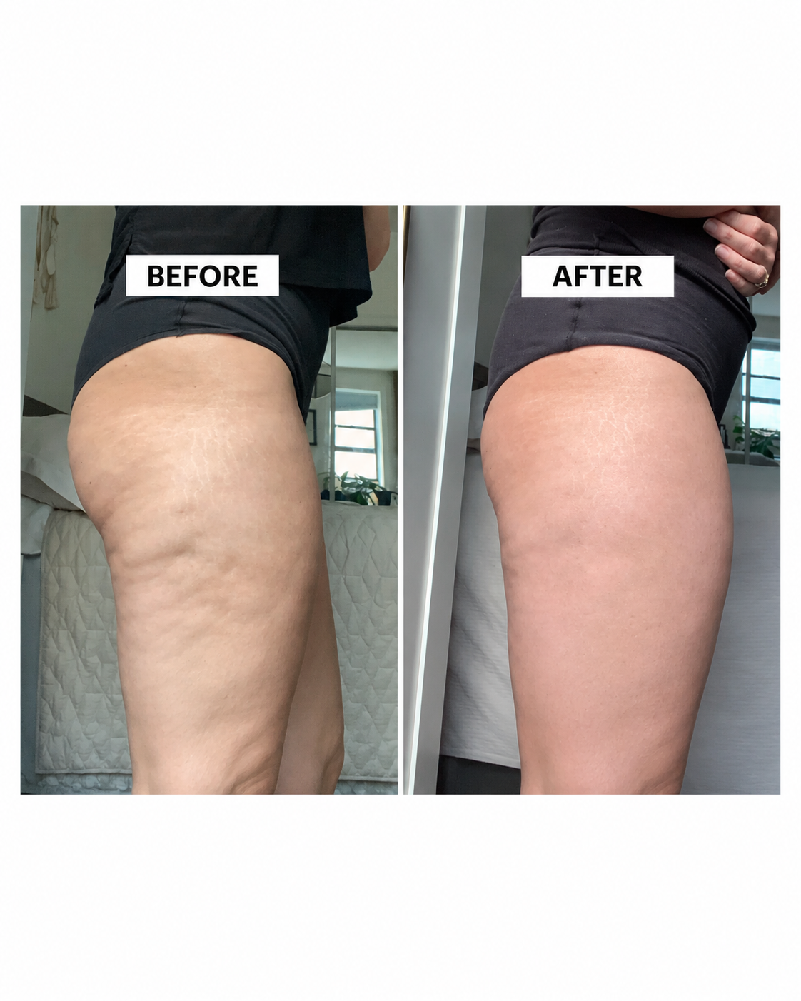 Bring Back Your Youth In 10 Days With Body Firming & Contouring Gel