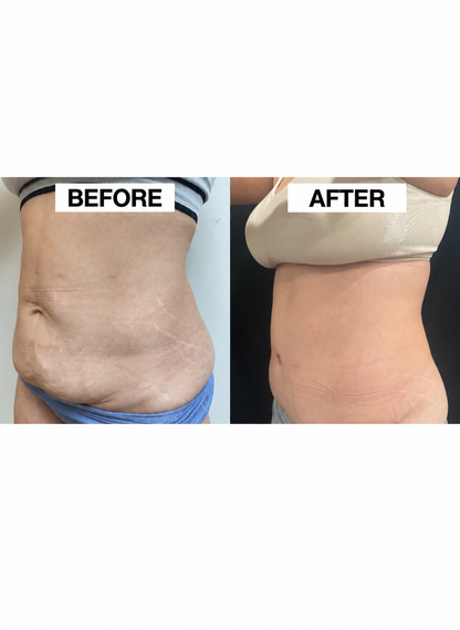 Bring Back Your Youth In 10 Days With Body Firming & Contouring Gel